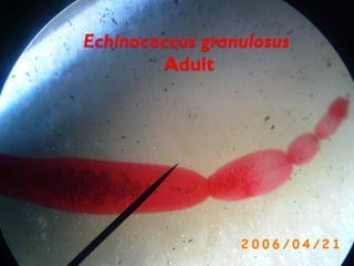 Echinococcus granulosus
Adult
 