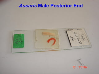 Ascaris Male Posterior End
 