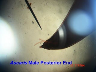 Ascaris Male Posterior End
 
