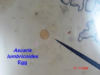 Ascaris
lumbricoides
Egg
 