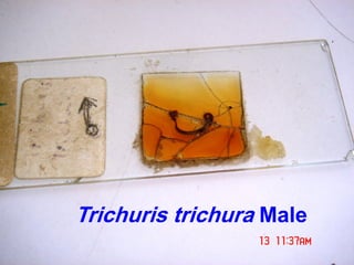 Trichuris trichura Male
 