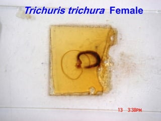 Trichuris trichura Female
 