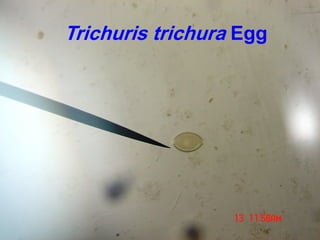 Trichuris trichura Egg
 