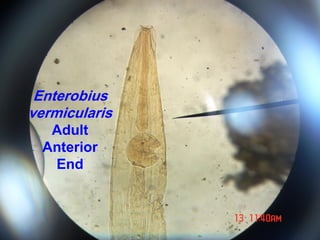 Enterobius
vermicularis
Adult
Anterior
End
 