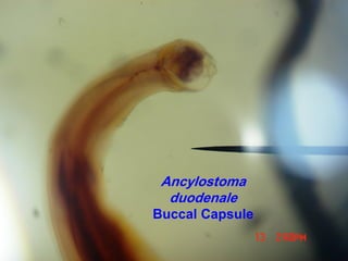 Ancylostoma
duodenale
Buccal Capsule
 