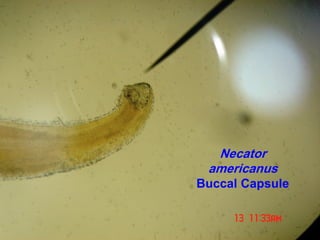 Necator
americanus
Buccal Capsule
 