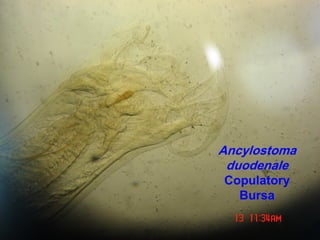 Ancylostoma
duodenale
Copulatory
Bursa
 
