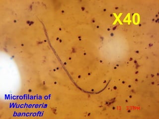 Microfilaria of
Wuchereria
bancrofti
X40
 