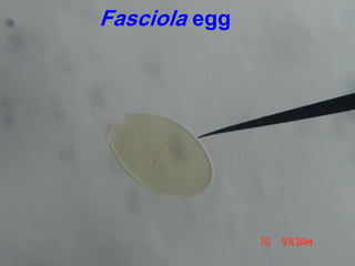 Fasciola egg
 