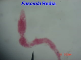 Fasciola Redia
 
