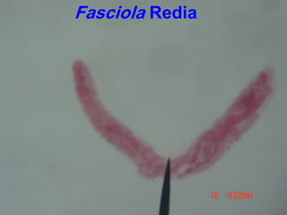 Fasciola Redia
 