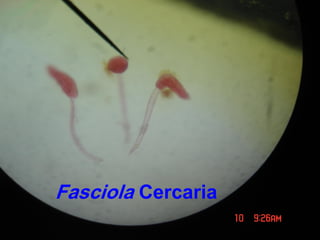 Fasciola Cercaria
 