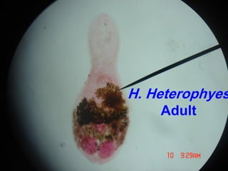 H. Heterophyes
Adult
 