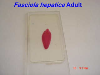 Fasciola hepatica Adult
 