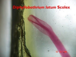 Diphyllobothrium latum Scolex
 
