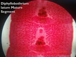 Practical revision part 1 helminths