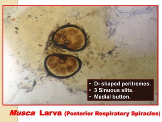 Musca Larva (Posterior Respiratory Spiracles)
• D- shaped peritremes.
• 3 Sinuous slits.
• Medial button.
 