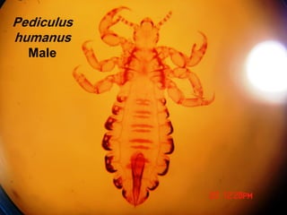Pediculus
humanus
Male
 