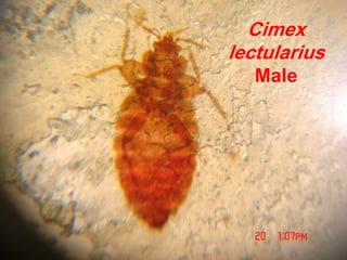 Cimex
lectularius
Male
 