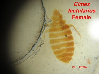 Cimex
lectularius
Female
 