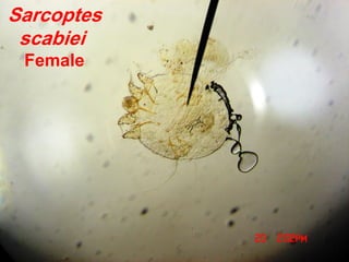 Sarcoptes
scabiei
Female
 