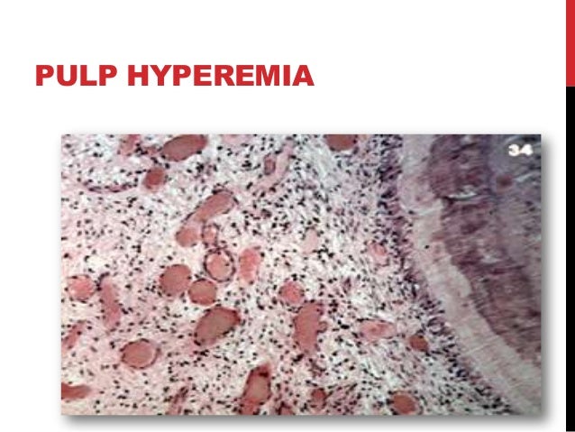 practical section of pulp and periapical diseases ludwig s angina