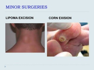 MINOR SURGERIES

LIPOMA EXCISION   CORN EXISION
 