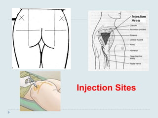 Injection Sites
 