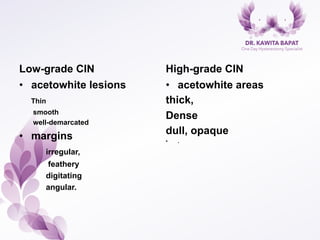 Low-grade CIN
•  acetowhite lesions
Thin
smooth
well-demarcated
•  margins
irregular,
feathery
digitating
angular.
High-grade CIN
•  acetowhite areas
thick,
Dense
dull, opaque
•  .
 