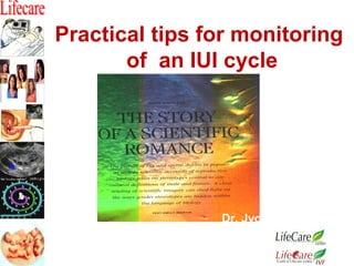 Practical tips for monitoring
of an IUI cycle
Dr. Jyoti Agarwal
Director
 