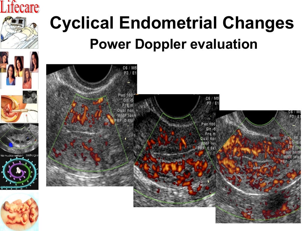 Practical tips for monitoring of an iui cycle