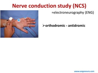 Nerve conduction study (NCS)
=electroneurography (ENG)
www.varganeuro.com
orthodromic - antidromic
 