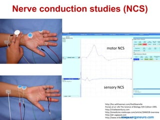 Nerve conduction studies (NCS)
motor NCS
sensory NCS
http://bcs.whfreeman.com/thelifewire9e
Purves et al. Life The Science of Biology IVth Edition 1995.
http://chadwaterbury.com
http://emedicine.medscape.com/article/1846028-overview
http://jdr.sagepub.com
http://www.erikstalberg.com/www.varganeuro.com
 