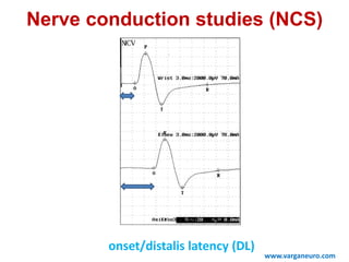 onset/distalis latency (DL)
Nerve conduction studies (NCS)
www.varganeuro.com
 