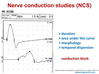 Nerve conduction studies (NCS)
duration
area under the curve
morphology
temporal dispersion
www.varganeuro.com
conduction block
https://mmcneuro.files.wordpress.com/2012/12/mmn-cb.jpg?w=271&h=322
 