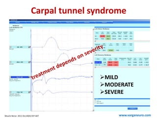 Carpal tunnel syndrome
www.varganeuro.com
MILD
MODERATE
SEVERE
Muscle Nerve. 2011 Oct;44(4):597-607
 