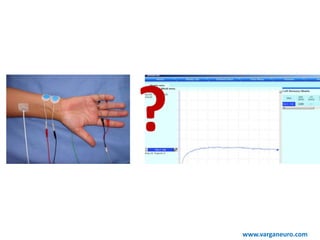 ?
www.varganeuro.com
 