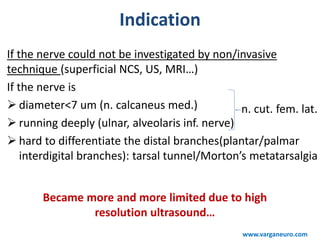 Indication
If the nerve could not be investigated by non/invasive
technique (superficial NCS, US, MRI…)
If the nerve is
 diameter<7 um (n. calcaneus med.)
 running deeply (ulnar, alveolaris inf. nerve)
 hard to differentiate the distal branches(plantar/palmar
interdigital branches): tarsal tunnel/Morton’s metatarsalgia
n. cut. fem. lat.
Became more and more limited due to high
resolution ultrasound…
www.varganeuro.com
 
