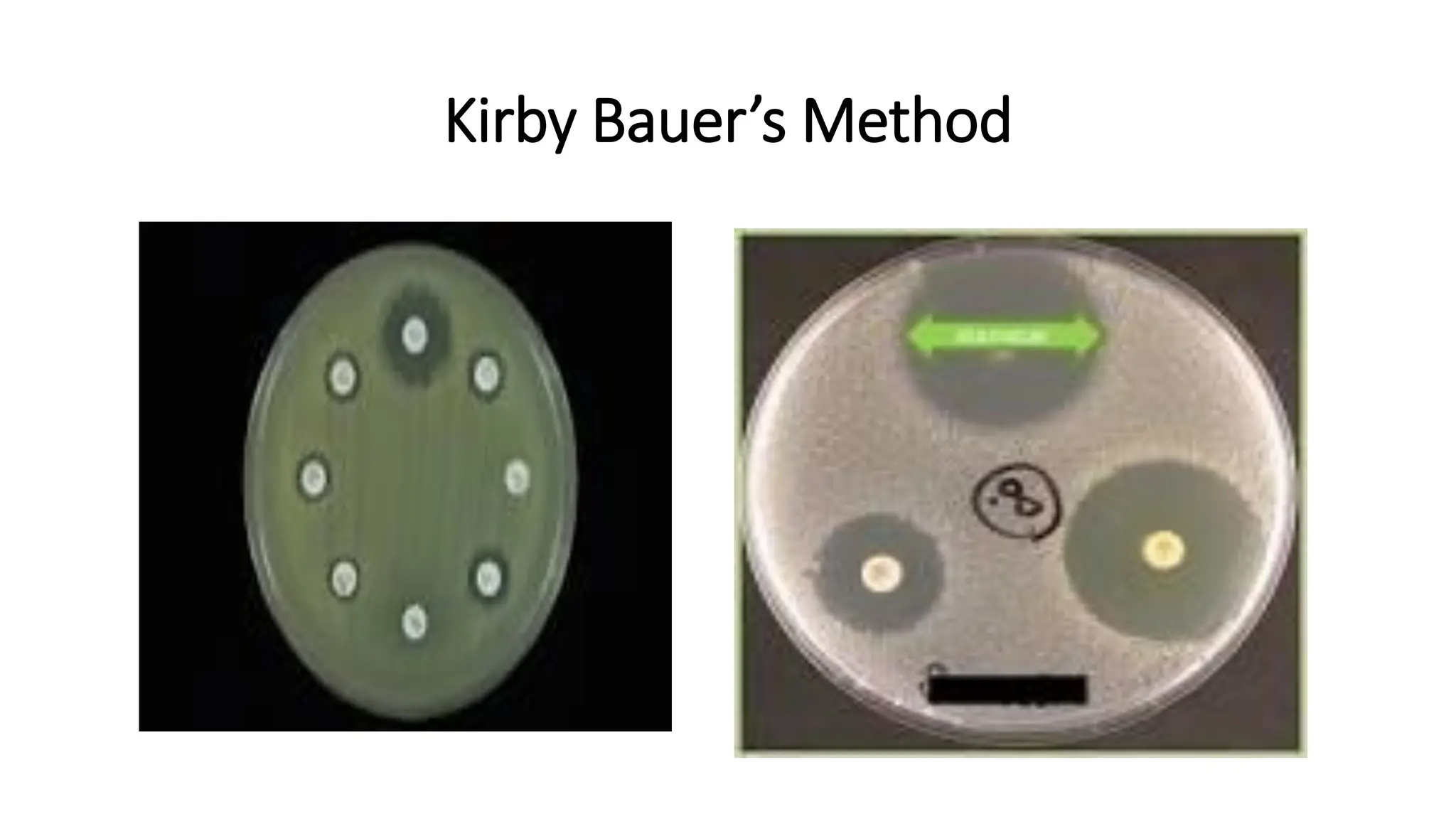 Kirby Bauer’s Method
 