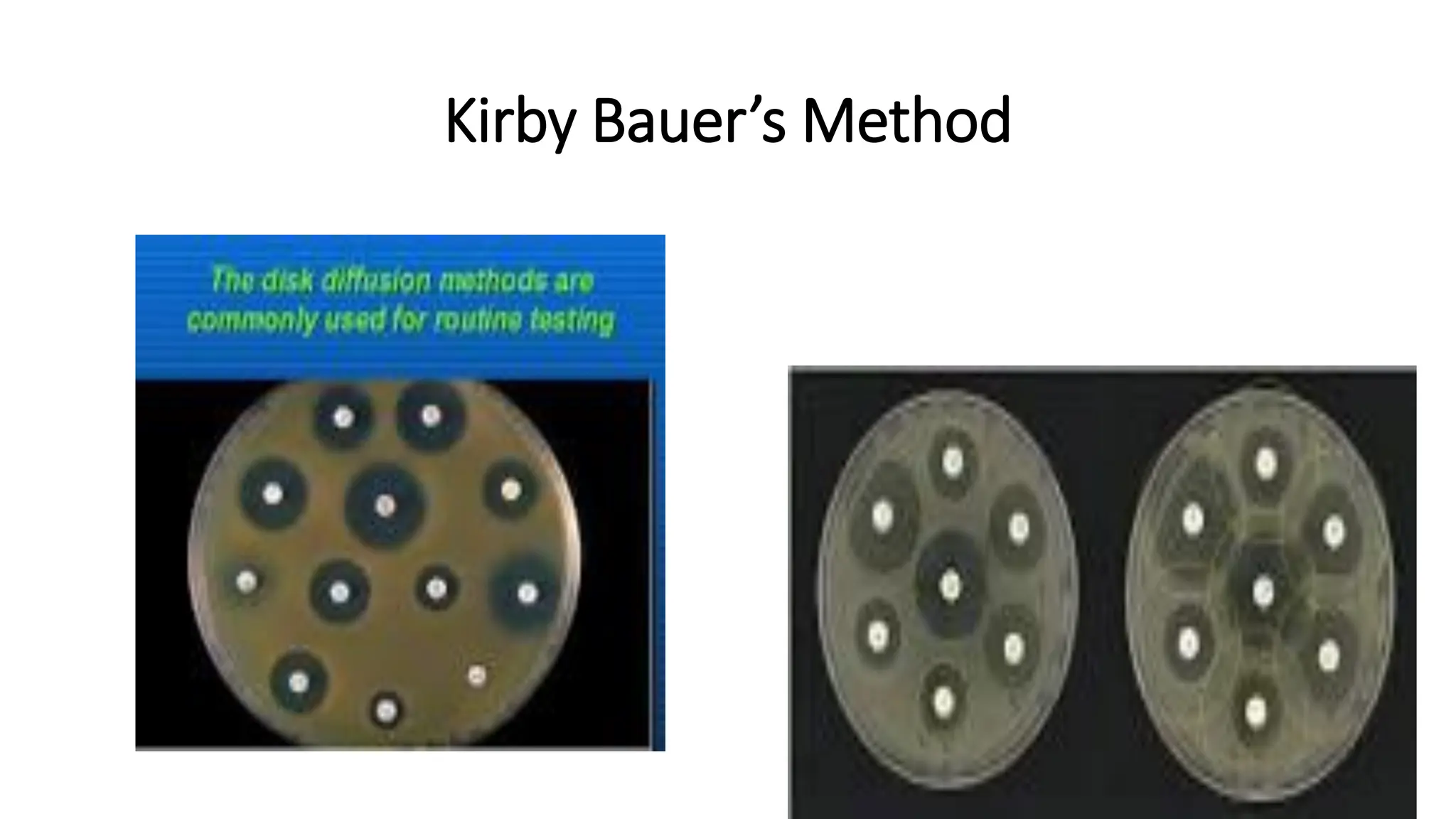 Kirby Bauer’s Method
 