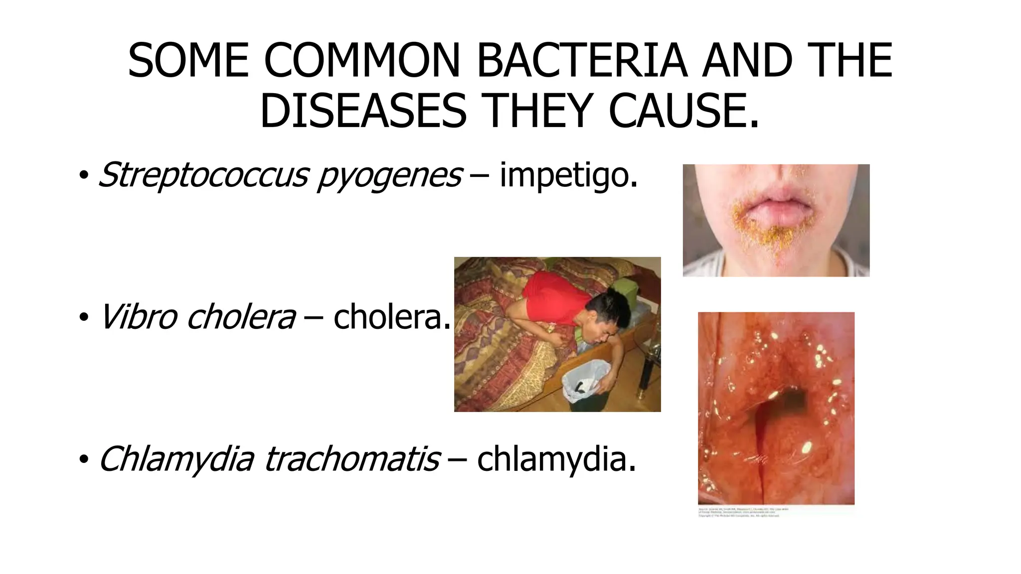 SOME COMMON BACTERIA AND THE
DISEASES THEY CAUSE.
• Streptococcus pyogenes – impetigo.
• Vibro cholera – cholera.
• Chlamydia trachomatis – chlamydia.
 