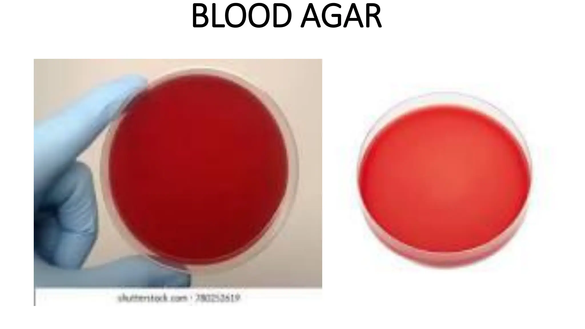 BLOOD AGAR
 