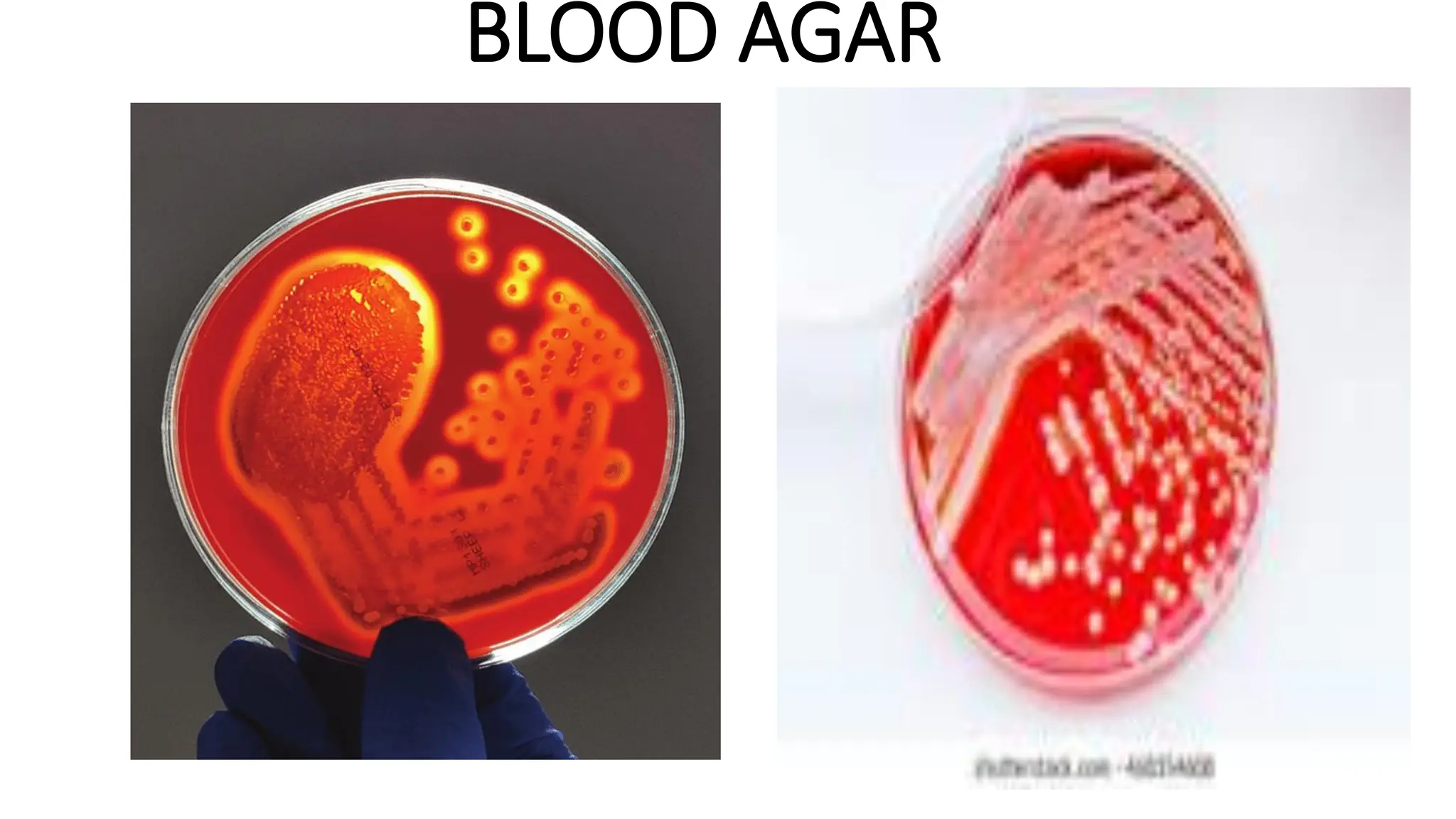BLOOD AGAR
 
