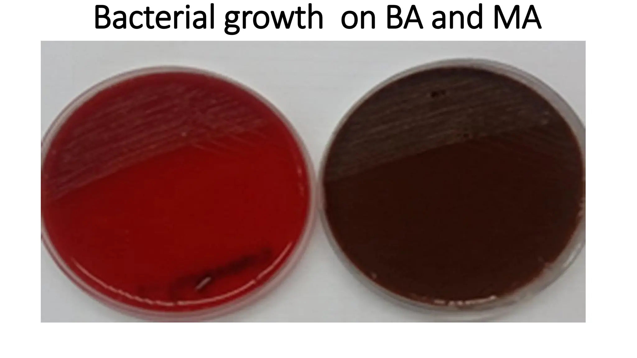 Bacterial growth on BA and MA
 