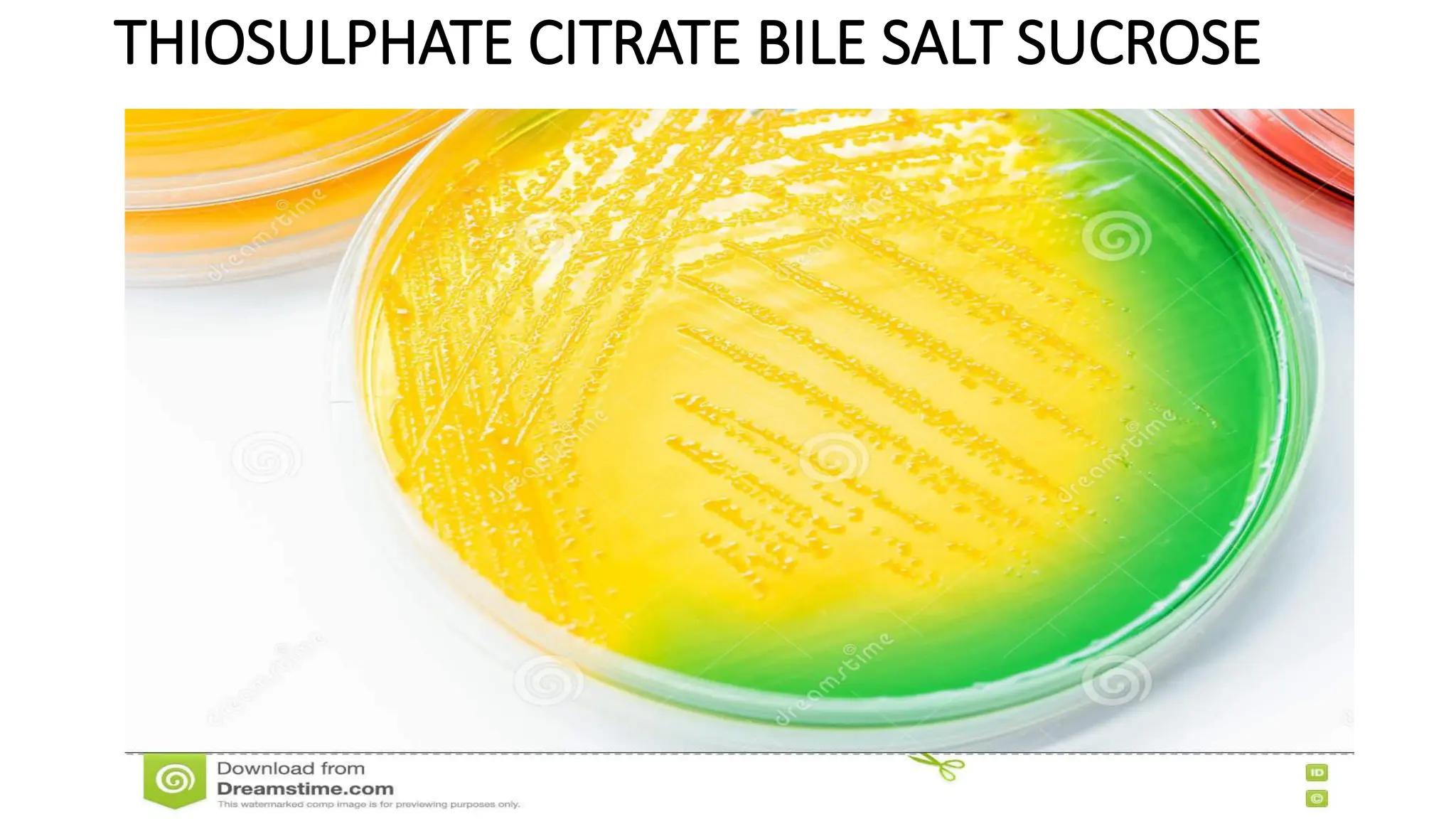 THIOSULPHATE CITRATE BILE SALT SUCROSE
 