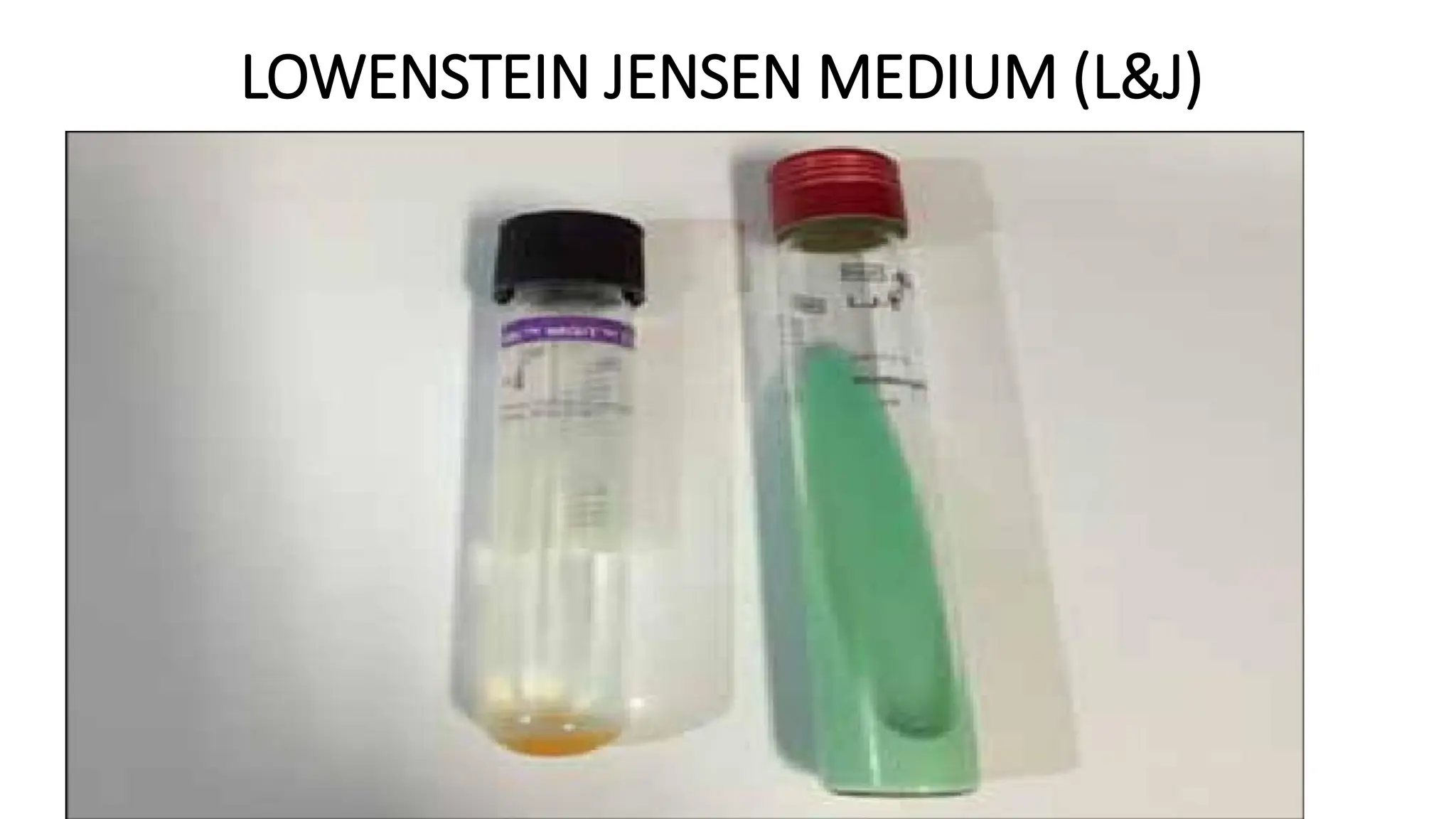 LOWENSTEIN JENSEN MEDIUM (L&J)
 
