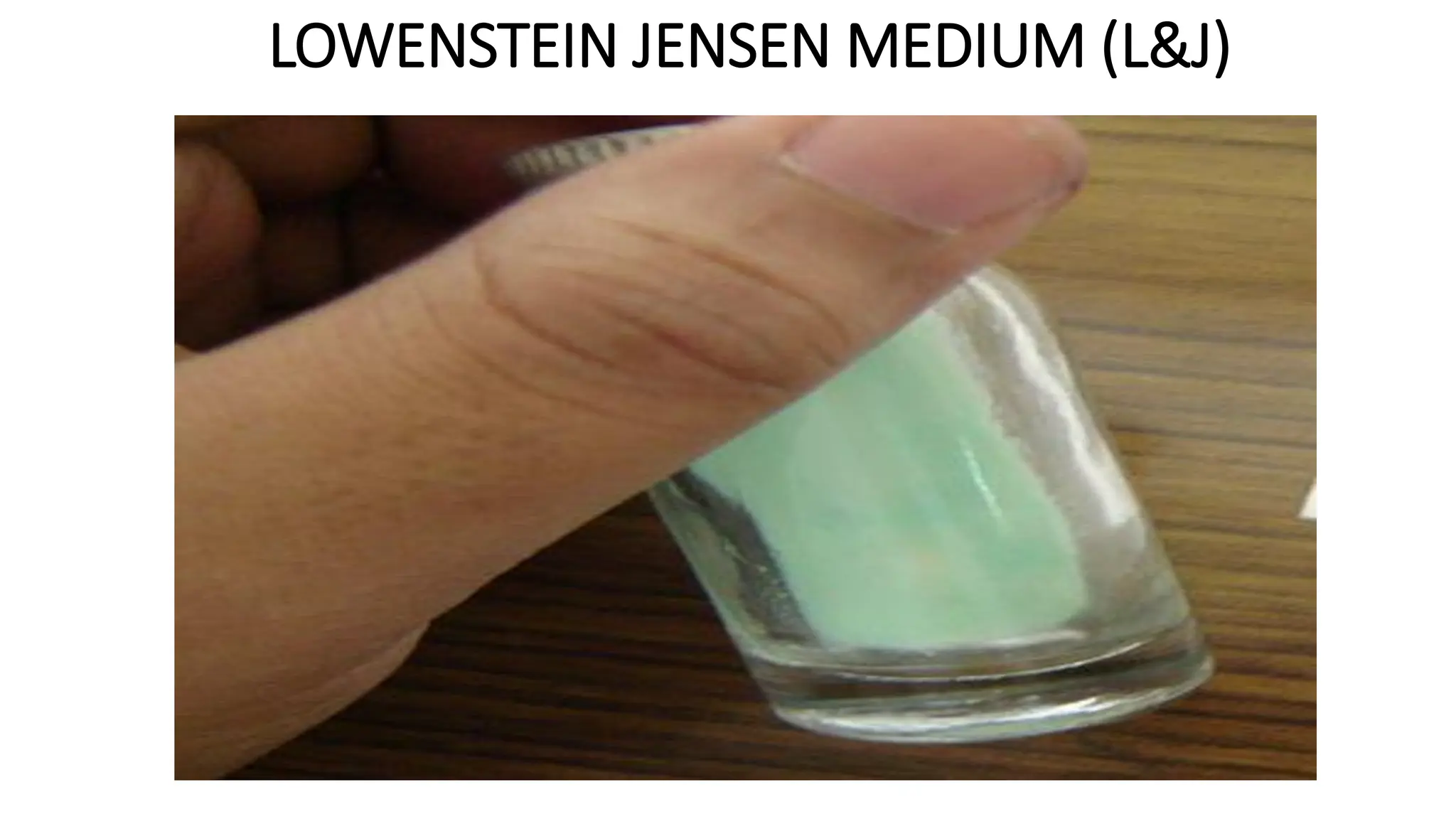 LOWENSTEIN JENSEN MEDIUM (L&J)
 