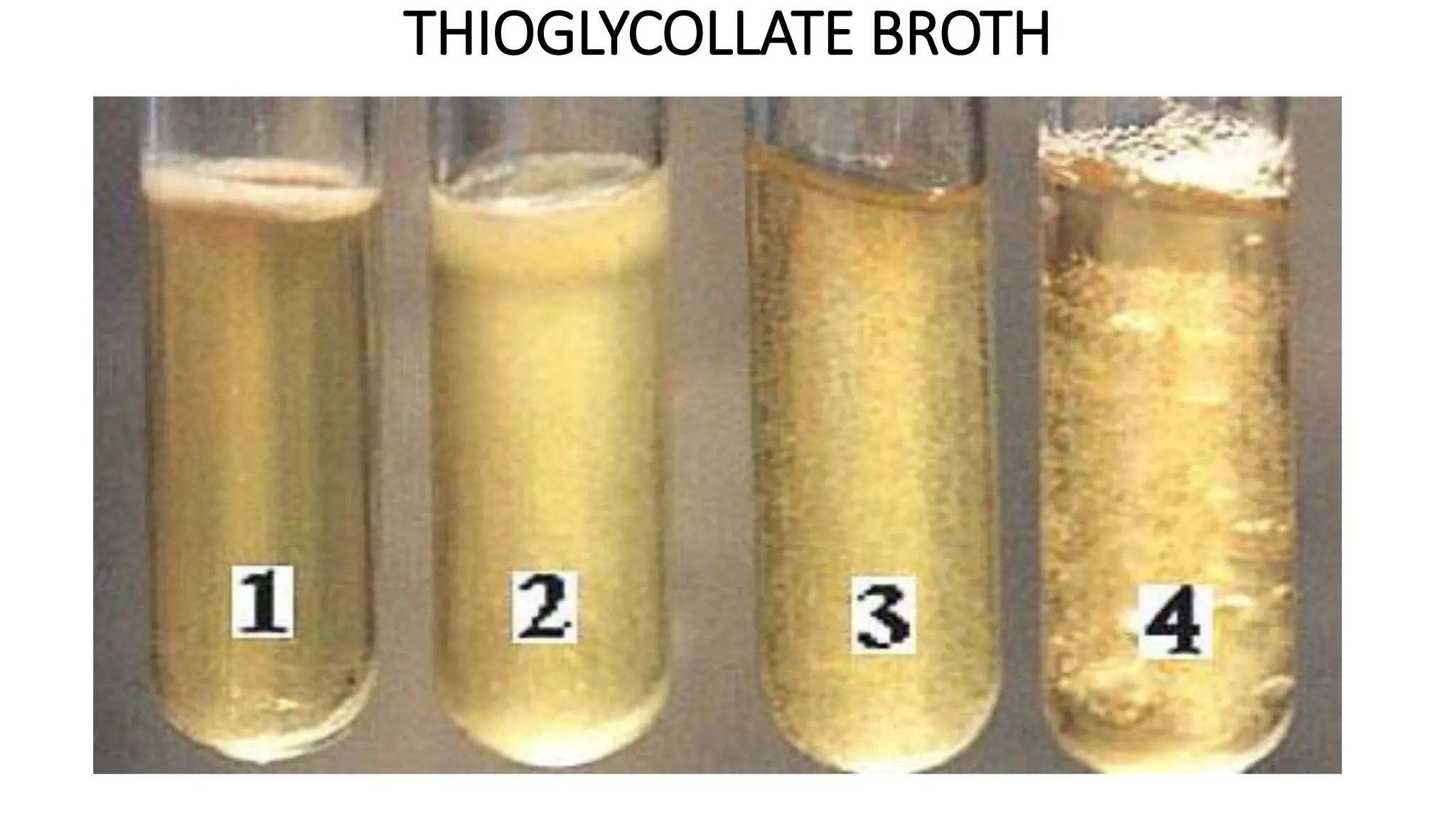 THIOGLYCOLLATE BROTH
 