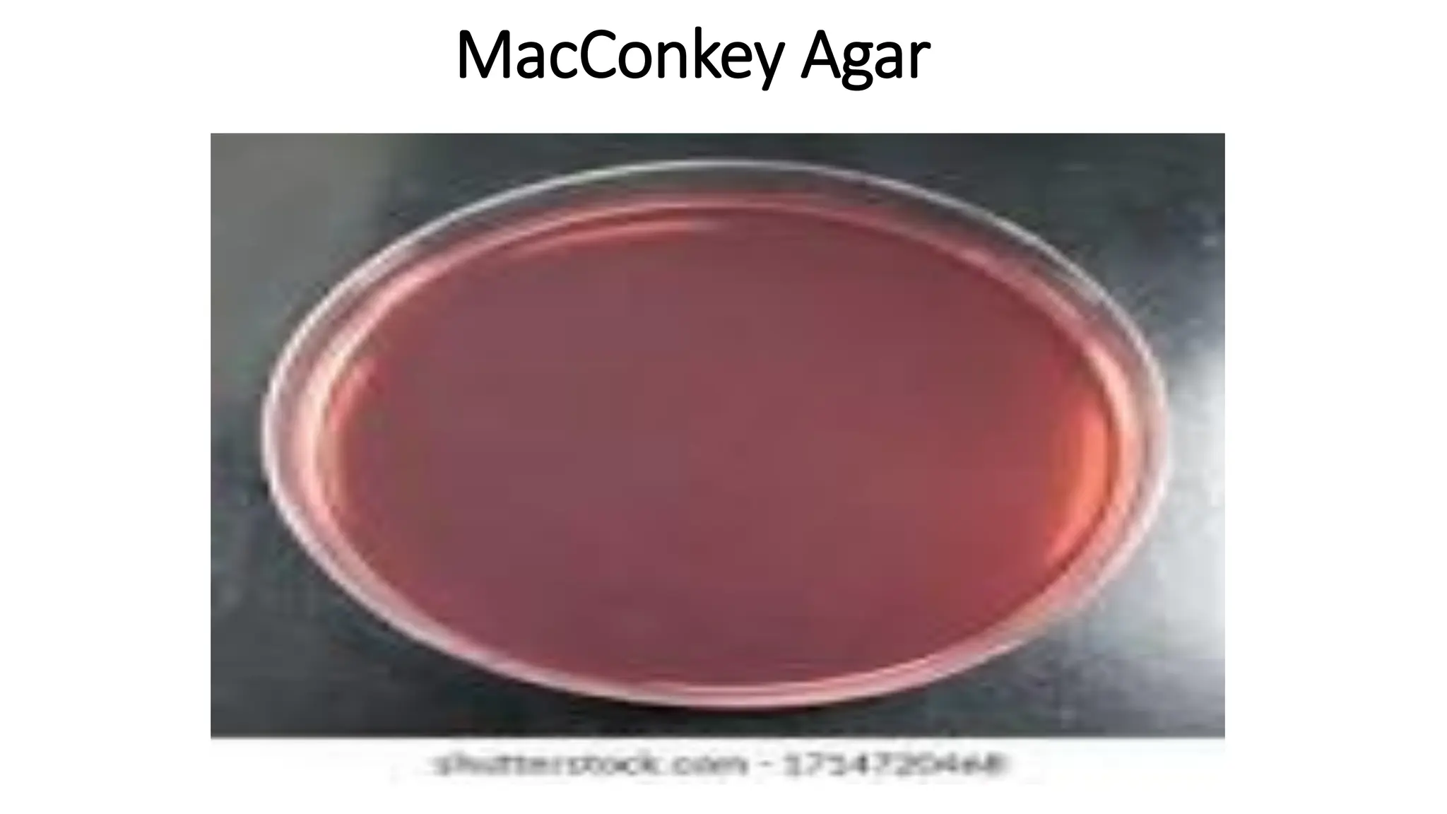 MacConkey Agar
 
