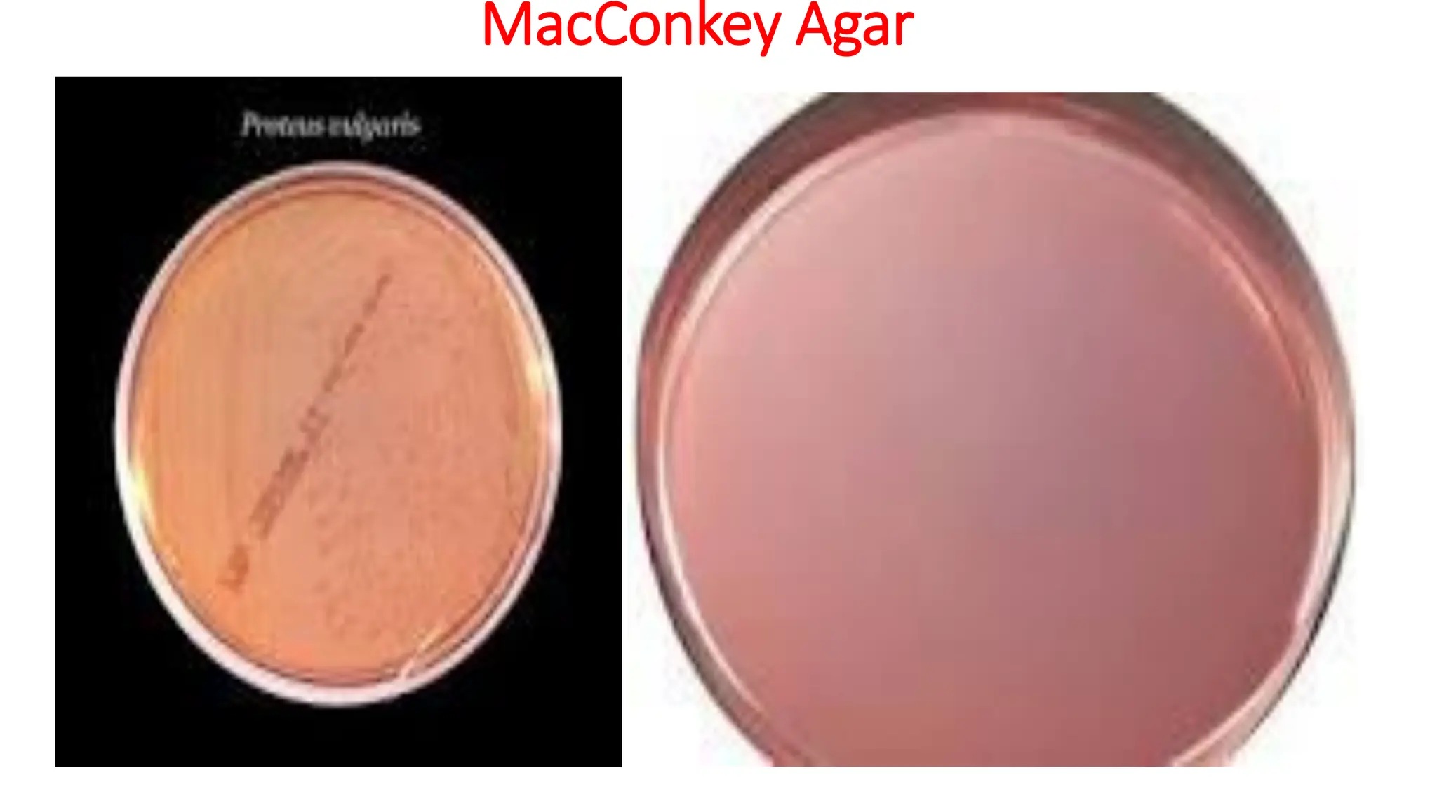 MacConkey Agar
 